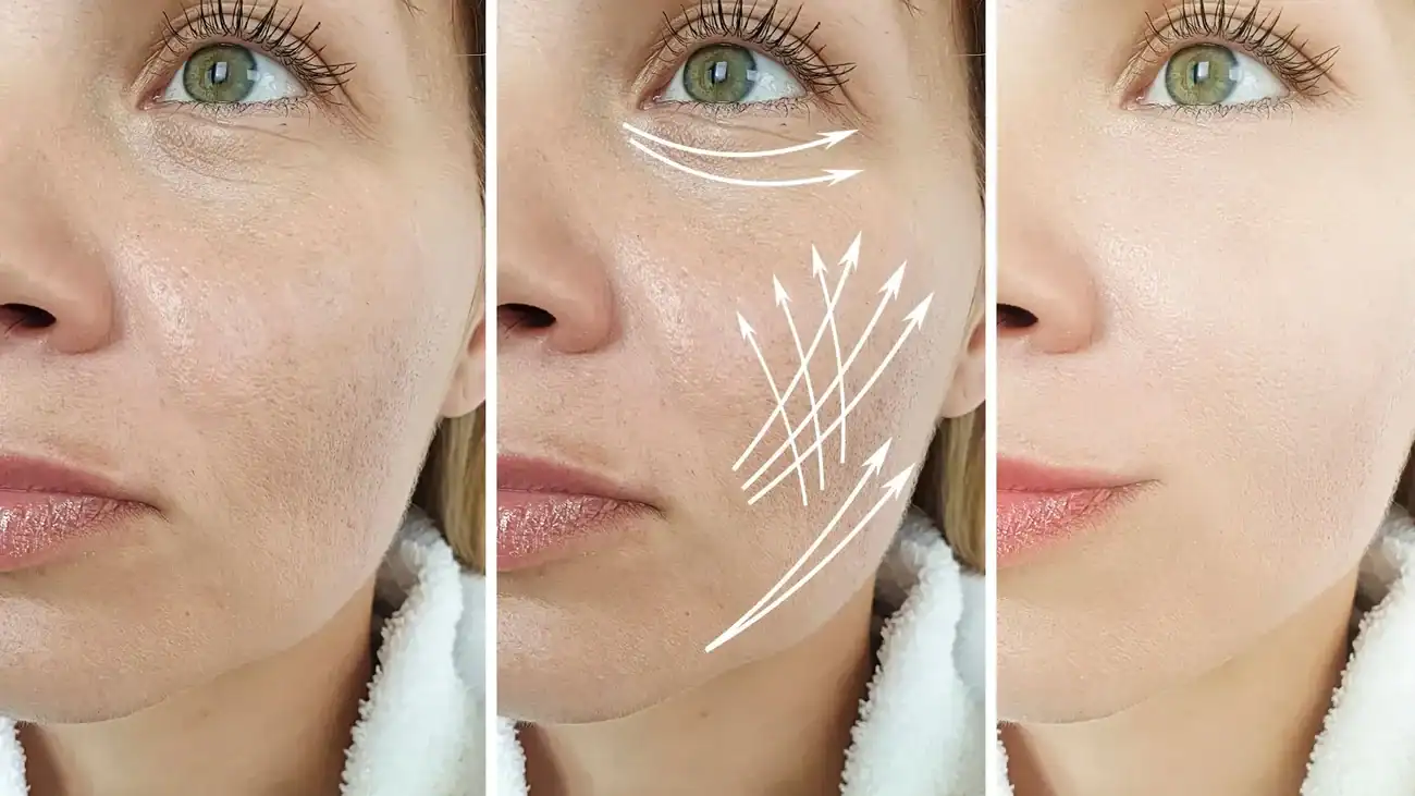 Can One Treatment Really Tackle More Than One Skin Concern Maidenhead?