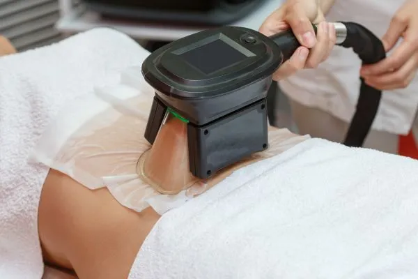 Image of person having fat freezing treatment to help weight gain Maidenhead