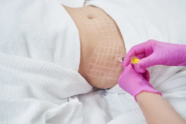 image of fat dissolving injections on love handles to help combat weight gain Maidenhead